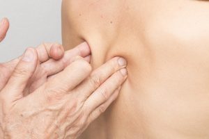 Sport Therapy in Auckland